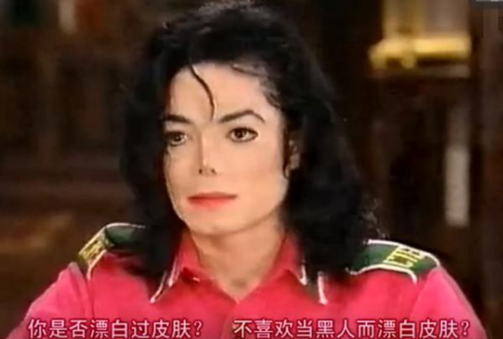 迈克尔杰克逊的皮肤怎么变白的