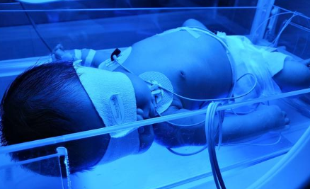 新生儿得了黄疸，医院建议照蓝光，什么是蓝光治疗？