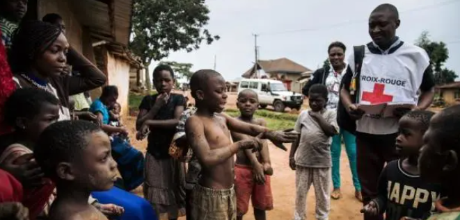 刚果金宣布新一轮埃博拉疫情暴发，当时市民需要注意哪些防范？