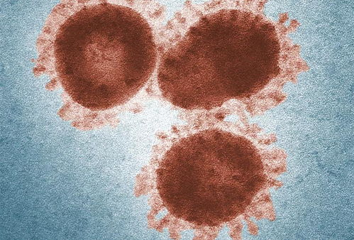 感染新型冠状病毒后有哪些表现？