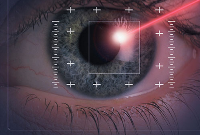激光近视手术的危害谁能说说啊？